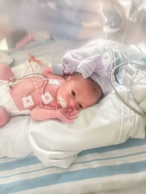 Neonatal Baby